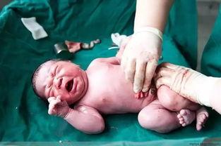 剖腹产视频全部过程,从麻醉到缝合，带你了解分娩新视角