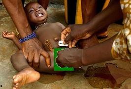 割礼视频,传统习俗与现代争议的视觉解读