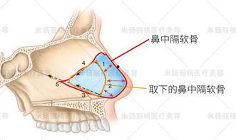 软骨视频,视频揭示软骨结构与功能